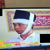 Apa mungkin kopiahnya sudah menempel permanen di kepala sampai nggak bisa dilepas? Sampai-sampai jadi ikutan di perban. Kalau lihat yang kayak gini kan jadi gagal sedih.. Foto: Twitter/@helmihelmi