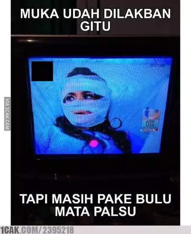 Apapun yang terjadi penampilan tetap harus on. Tak peduli wajah diperban sekalipun yang penting bulu mata dan makeup tetap membahana. Foto: 1cak.com