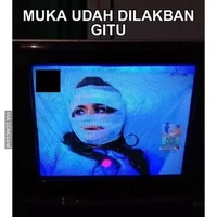 Apapun yang terjadi penampilan tetap harus on. Tak peduli wajah diperban sekalipun yang penting bulu mata dan makeup tetap membahana. Foto: 1cak.com