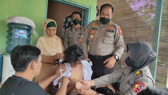 Memprihatinkan! Vicky Korban Kanjuruhan Susah Bicara-Gerakkan Anggota Badan