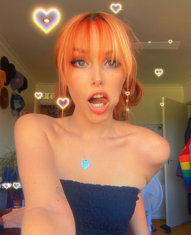 Akhirnya, Blume yang merasa dirinya sebagai seorang wanita memutuskan untuk operasi pembentukan vagina. Foto: Dok. Instagram/@blumekind_