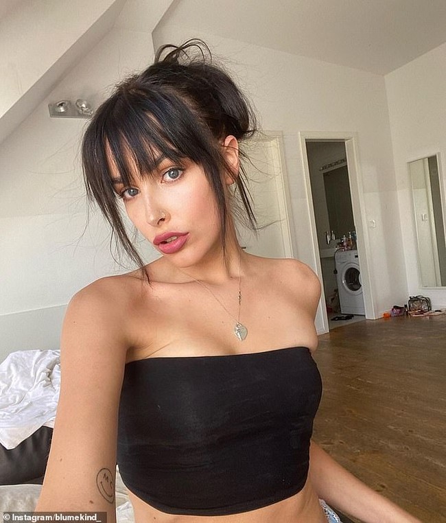 Ia menjelaskan bahwa kromosom XY tidak benar-benar terbentuk sebagai perempuan, begitu juga dengan alat kelamin pria yang tidak tumbuh sempurna. “Aku berada di antara keduanya,” jelas Blume, seperti dikutip dari Daily Mail. Foto: dok. Instagram