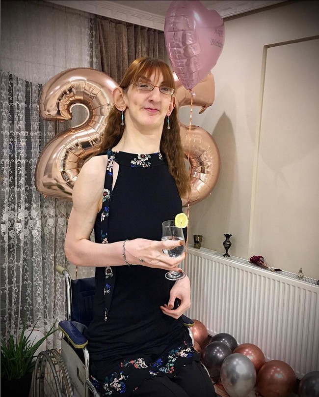 Rumeysa yang berasal dari provinsi Karabuk, Turki, memiliki kondisi genetik langka yang disebut Weaver Syndrome. Kondisi ini mempercepat pertumbuhannya dan membuat bagian tubuhnya jauh lebih besar dibandingkan ukuran manusia normal. Foto: Instagram/@rumeysagelgi