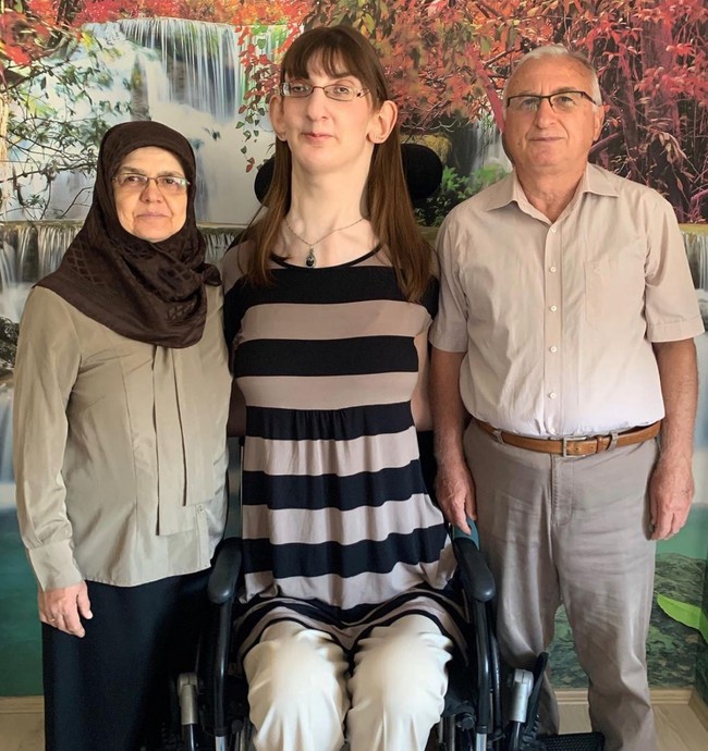 Rumeysa Gelgi menjalani kehidupan remajanya dengan banyak tantangan. Ia kerap diejek dan dilecehkan orang sekitarnya dulu karena penampilannya yang berbeda. Foto: Instagram/@rumeysagelgi