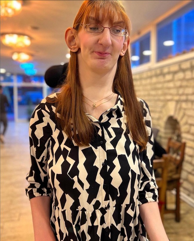 “Menjadi berbeda tidak seburuk yang kamu kira. Justru bisa membawamu kepada kesuksesan yang tak terduga,” pesan Rumeysa. Foto: Instagram/@rumeysagelgi