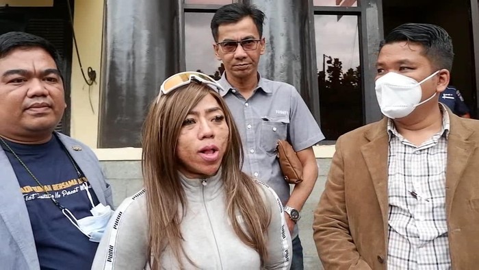 Atlet binaragawati Anoy Roz jadi korban penganiayaan driver ojol.