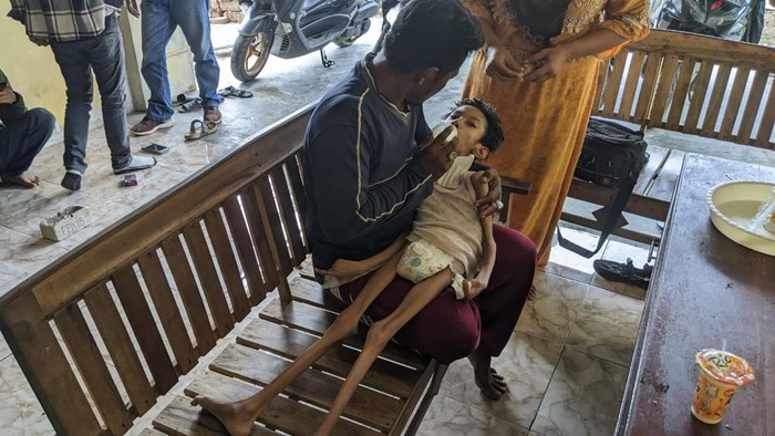 Lissa Ameliya Safitri, remaja putri di Indramayu yang ringkih sakit saraf kejepit