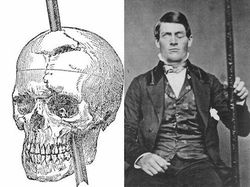 Awas Foto Ini Bisa Bikin Bergidik