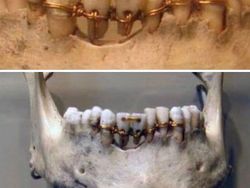 Awas Foto Ini Bisa Bikin Bergidik