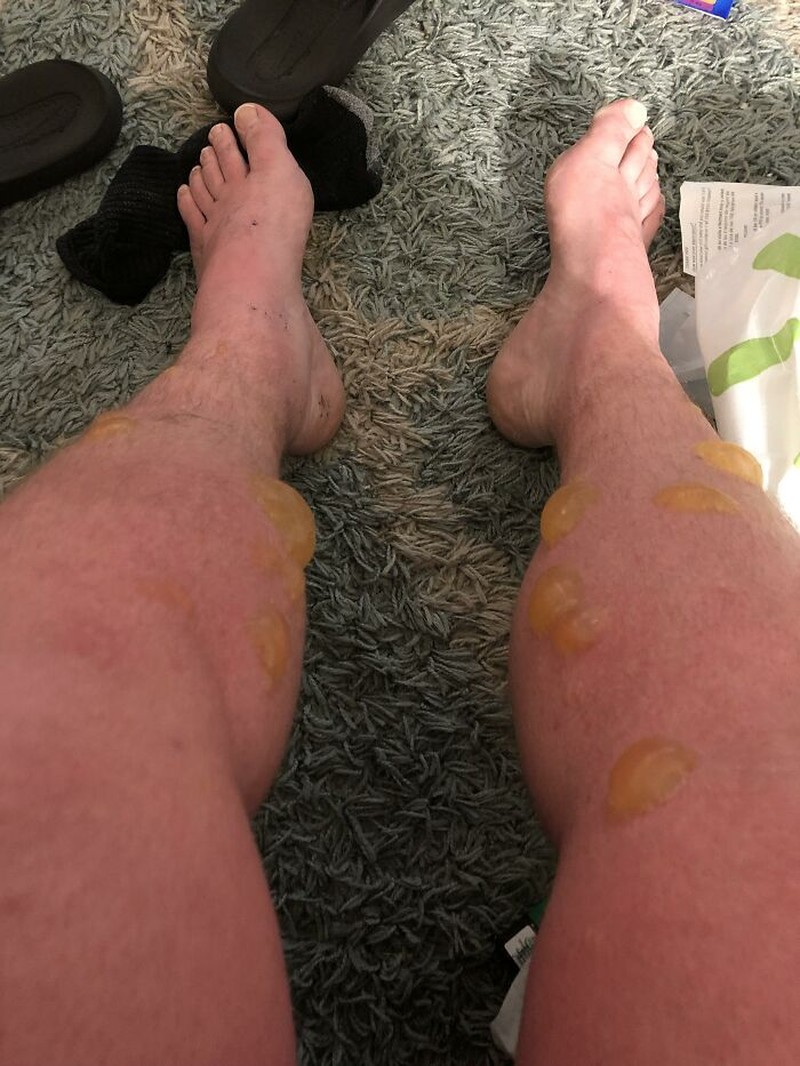 Deretan foto bikin bergidik