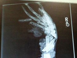 Awas Foto Ini Bisa Bikin Bergidik