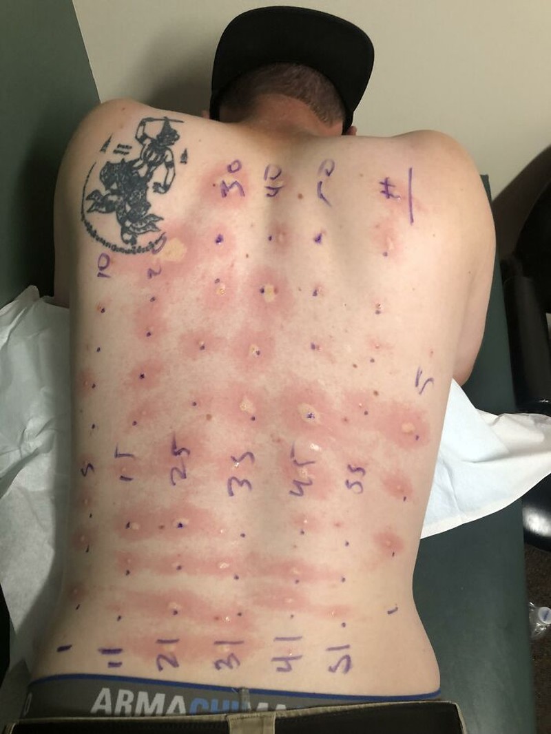 Deretan foto bikin bergidik