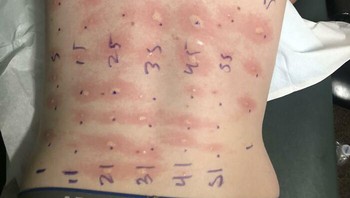 Berapa banyak alergi ya?. Foto: Boredpanda 