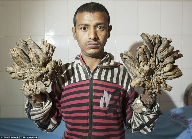 Deretan foto bikin bergidik