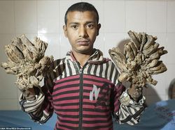 Awas Foto Ini Bisa Bikin Bergidik