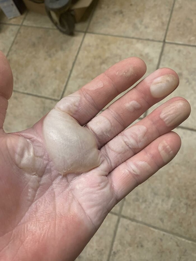 Deretan foto bikin bergidik