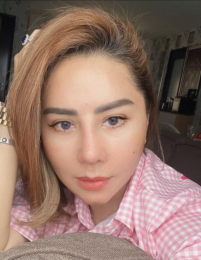 Perubahan wajah Femmy Permatasari terlihat signifikan 23 hari pascaoperasi. Namun beberapa bagian wajahnya masih mengalami bengkak. Foto: Instagram/@femmypermatasari