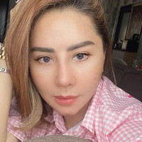 Perubahan wajah Femmy Permatasari terlihat signifikan 23 hari pascaoperasi. Namun beberapa bagian wajahnya masih mengalami bengkak. Foto: Instagram/@femmypermatasari