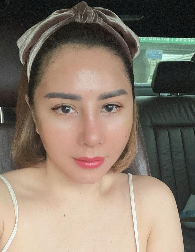 Dalam unggahan Instagram-nya, ibu tiga anak ini mengungkap kulit wajahnya masih terasa kencang. Dia juga tidak boleh duduk dengan posisi miring, harus terlentang. Foto: Instagram/@femmypermatasari