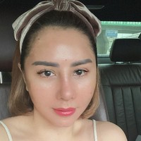 Dalam unggahan Instagram-nya, ibu tiga anak ini mengungkap kulit wajahnya masih terasa kencang. Dia juga tidak boleh duduk dengan posisi miring, harus terlentang. Foto: Instagram/@femmypermatasari