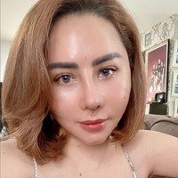 Femmy Permatasari juga masih merasakan nyeri di tulang iganya. Sebab sebagian kecil tulang iga diambil untuk ditambahkan pada bagian hidung. Foto: Instagram/@femmypermatasari