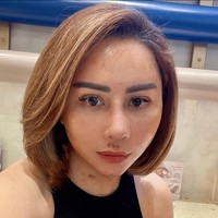 Sebelumnya Femmy Permatasari juga sudah memperlihatkan wajah 17 hari setelah operasi plastik. Saat itu wajahnya masih sangat bengkak dan terdapat memar di bagian hidung. Foto: Instagram/@femmypermatasari