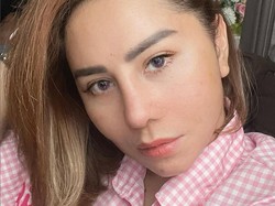 7 Foto Femmy Permatasari 23 Hari Pascaoperasi Plastik, Ini Wajah Barunya