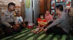 Kapolda Riau Janji Obati Kakak-Adik Penderita Tulang Rapuh di Pekanbaru