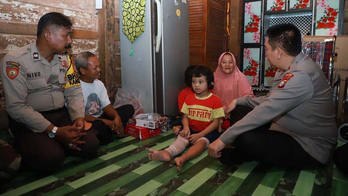 Kapolda Riau Irjen Mohammad Iqbal menjenguk kakak beradik penderita kelainan tulang rapuh di Padang Bulan, Senapelan, Pekanbaru, Kamis (10/11/2022).