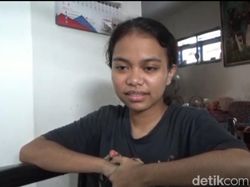 Pilu Dian Masih Hilang Ingatan Pasca 40 Hari Tragedi Kanjuruhan