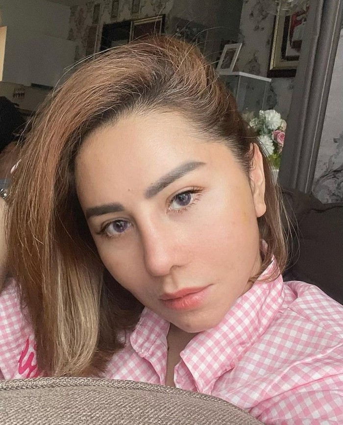 Potret Femmy Permatasari Asyik Ngopi di Korea Pascaoperasi Plastik