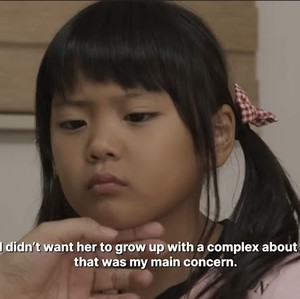 Jadi Kontroversi, Anak 9 Tahun Didukung Ibu Operasi Plastik Demi Jadi Cantik