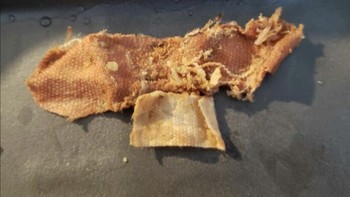 Tidak sengaja menelan plester di makanan. Restorannya harus blacklist nih. Foto: Twitter