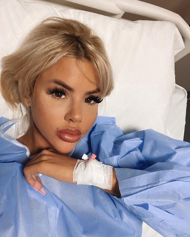 Tak hanya operasi mata yang dibutuhkan untuk Hannah terlihat seperti Bratz. Boneka yang dikenal dengan mata bulat dan foxy, bibir tebal, dan rahang tegas tersebut juga melakukan prosedur lain, seperti operasi payudara dan filler bibir.Foto: Instagram