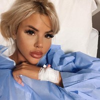 Tak hanya operasi mata yang dibutuhkan untuk Hannah terlihat seperti Bratz. Boneka yang dikenal dengan mata bulat dan foxy, bibir tebal, dan rahang tegas tersebut juga melakukan prosedur lain, seperti operasi payudara dan filler bibir.Foto: Instagram