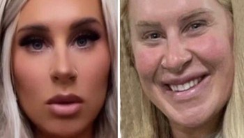 Ngakunya tidak pernah pakai filter. Foto: Reddit via Boredpanda