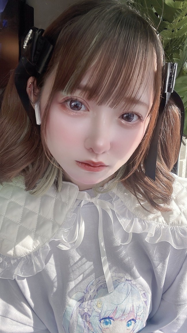 Kepercayaan diri Zirazyo memang meningkat setelah melakukan operasi. Setelah menjalani tiga prosedur dikatakan jika penampilannya berubah drastis dan sejak itu orang-orang jadi lebih mengenal sosoknya lebih dalam.Foto: TikTok/Twitter Zirazyo