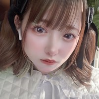 Kepercayaan diri Zirazyo memang meningkat setelah melakukan operasi. Setelah menjalani tiga prosedur dikatakan jika penampilannya berubah drastis dan sejak itu orang-orang jadi lebih mengenal sosoknya lebih dalam.Foto: TikTok/Twitter Zirazyo