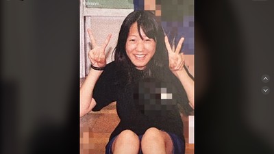 Transformasi Wanita yang Jadi Kontroversi, Operasi Plastik Sejak Kelas 5 SD