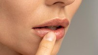 Bye-bye Bibir Pecah-Pecah! Ini Cara Atasi Bibir Kering saat Puasa Menurut Dokter