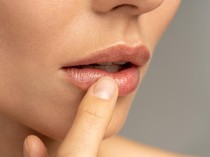 Bye-bye Bibir Pecah-Pecah! Ini Cara Atasi Bibir Kering saat Puasa Menurut Dokter