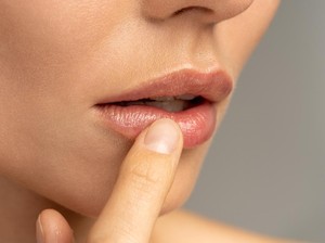 Sering Minum tapi Bibir Tetap Kering dan Pecah-pecah, Bagaimana Mengatasinya Dok?