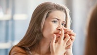 Jerawat di Hidung karena Apa? Kenali Penyebabnya