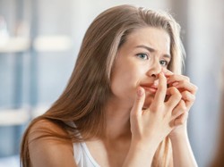 5 Cara Mengatasi Jerawat di Hidung