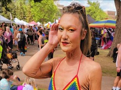 8 Potret Model dengan Kondisi Langka, Kulit Keriput di Usia 31 Tahun