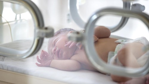 Ilustrasi Bayi Prematur