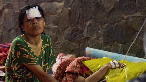 Korban luka akibat gempa bumi mendapat perawatan di RSUD Cianjur, Senin (21/11/2022). Mayoritas korban menderita luka di bagian kepada dan tangan.
