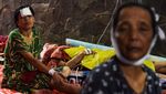 Melihat Lagi Kondisi Luka yang Diderita Korban Gempa Cianjur