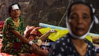 Korban luka mendapat perawatan di tenda darurat RSUD Cianjur, Senin (21/11/2022).