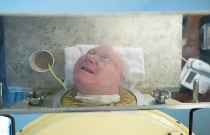 Paul Alexander paru-paru besi